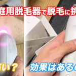 家庭用レーザー脱毛器トリアを3ヶ月使った感想・レビュー【効果はある？痛い？】